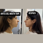Mouth tape para mandíbula definida