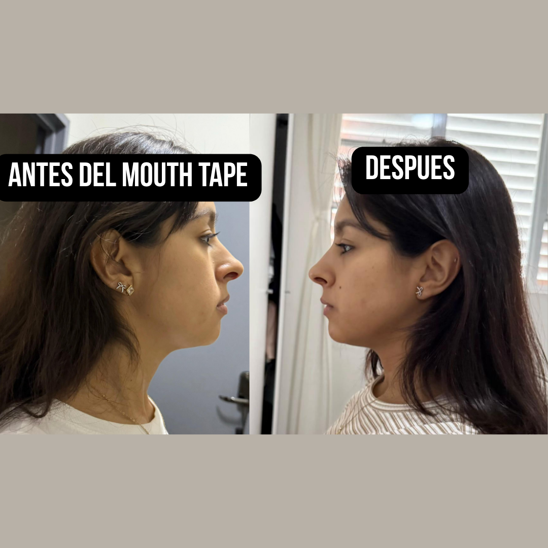 Mouth tape para mandíbula definida