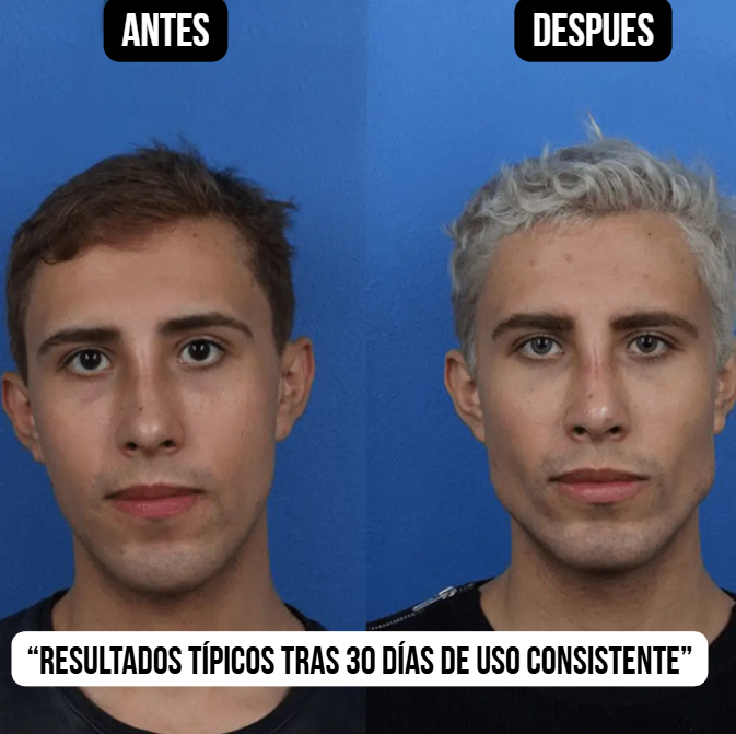 Mouth tape para mandíbula definida